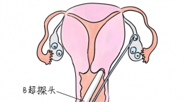 幼儿学画画，烟台捐卵宝宝学画画，学画画的好处，如何学画画