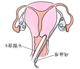 幼儿学画画，烟台捐卵宝宝学画画，学画画的好处，如何学画画