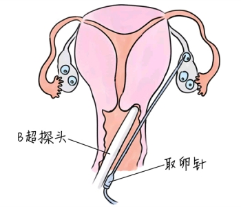 幼儿学画画，烟台捐卵宝宝学画画，学画画的好处，如何学画画